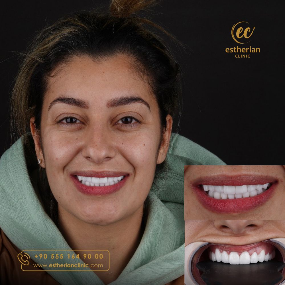 hadeel dental results