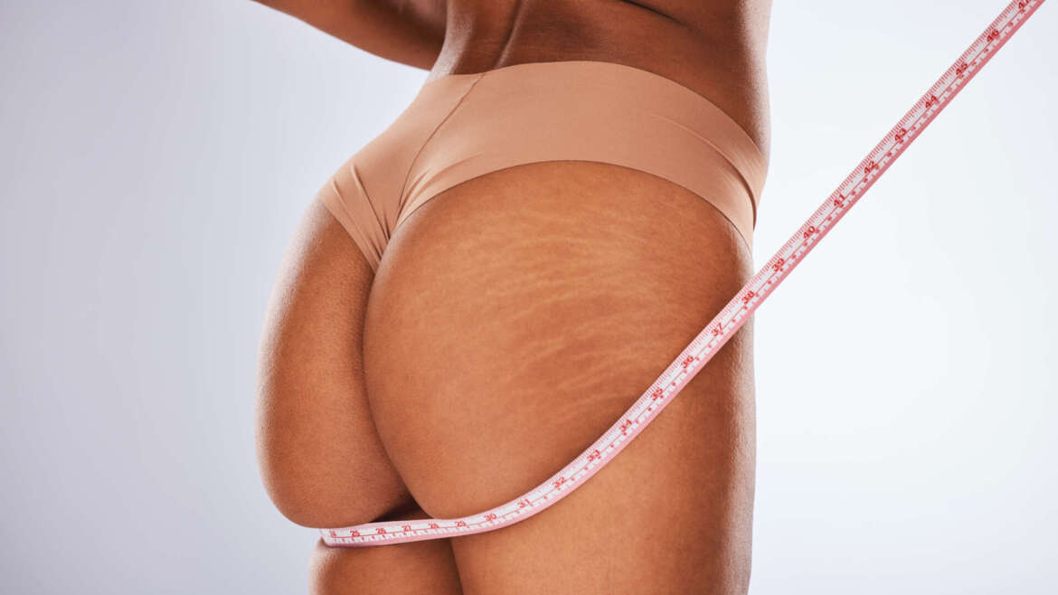 J-Plasma: Liposuction’ın Yenilikçi Tamamlayıcısı