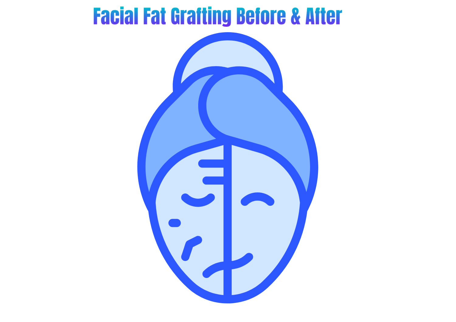 Facial fat grafting