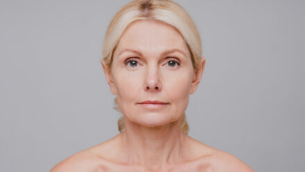 Fix sagging jowls