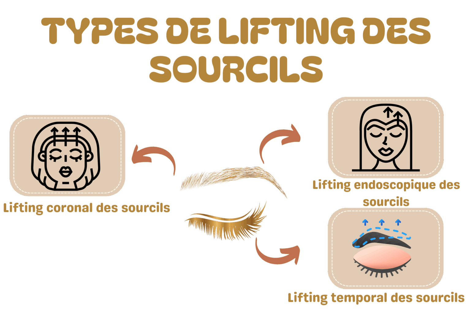 Types de Lifting des Sourcils