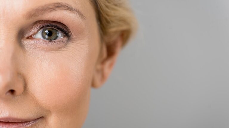 Eyelid Surgery before and after