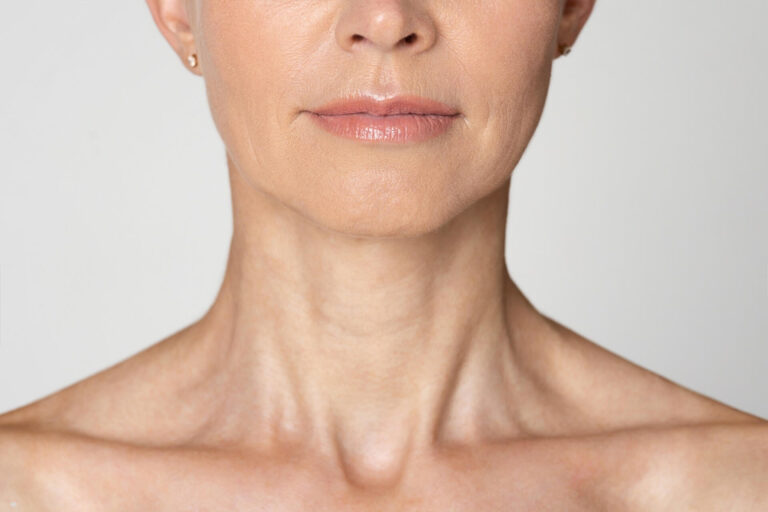 Best Treatment for Neck Sagging