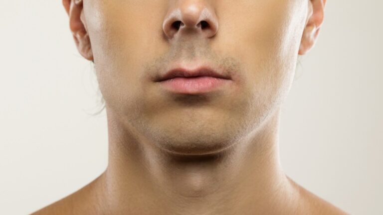 Chin implant for men
