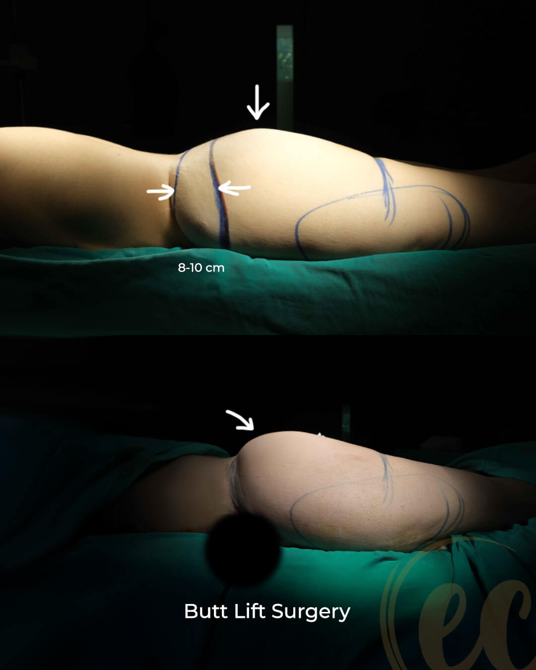 Medical procedure result