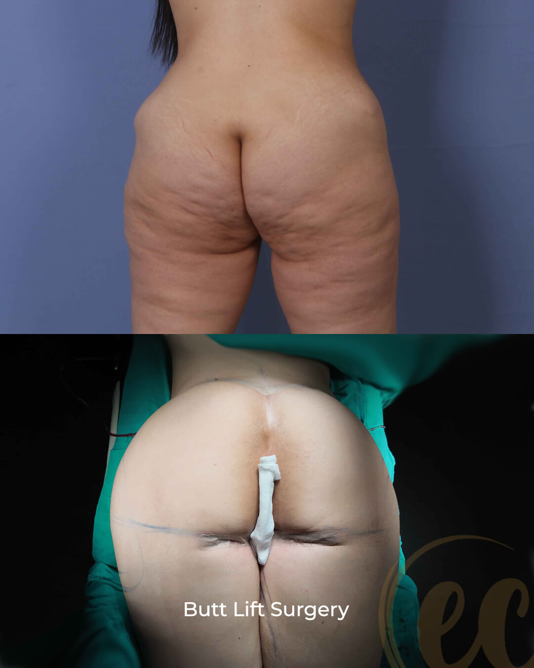 Medical procedure result