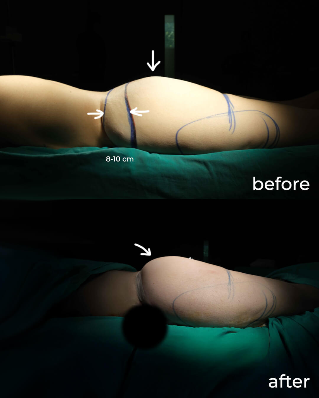 Medical procedure result