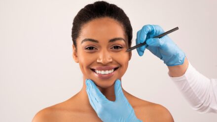 chin implant recovery