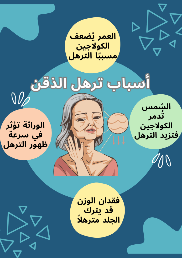 أسباب ترهل الذقن 