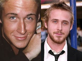 Ünlü rinoplasti Ryan Gosling burun estetiği ameliyatı öncesi ve sonrası