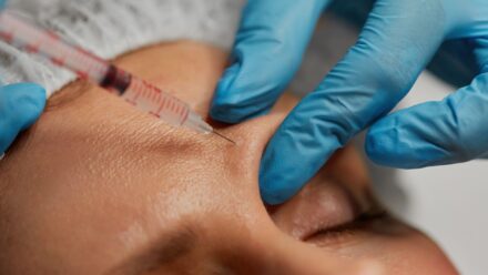 Face Sculpting - Explore the Non-surgical Treatments
