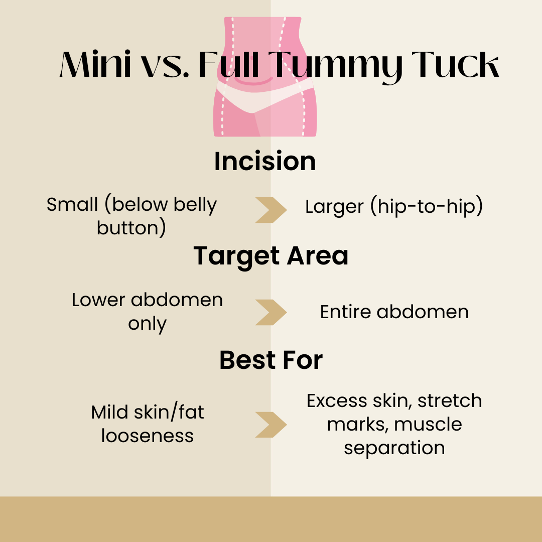 inforgraphic: Mini Vs. Full Tummy Tuck