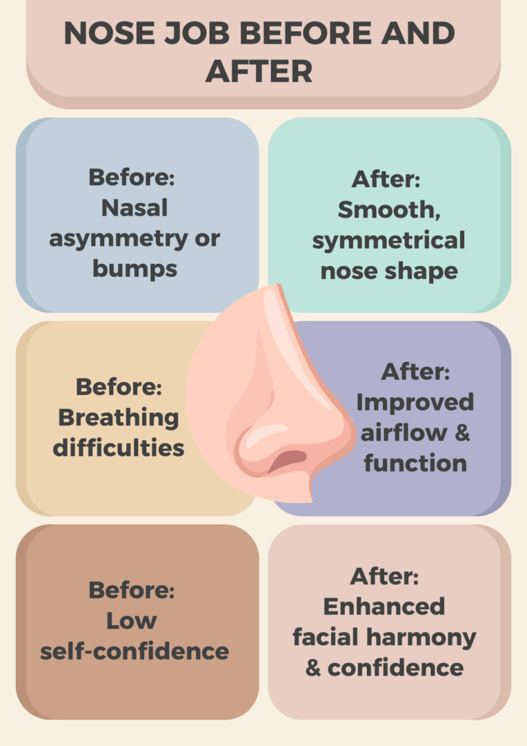 Infographic: Nose Job Before and After