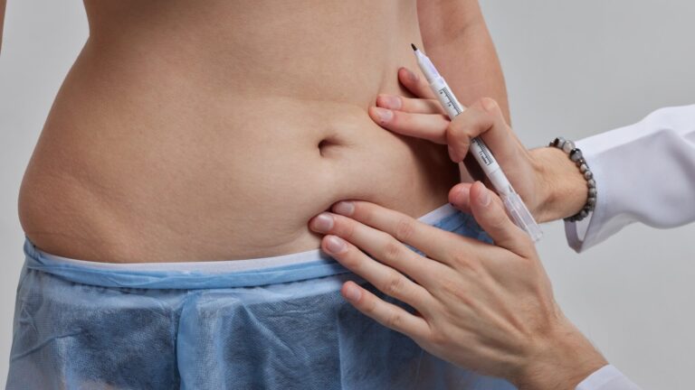 Stomach Skin Removal Surgery – Explore the Procedure & Cost