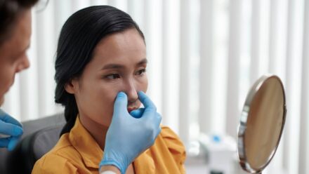 nose job before and after