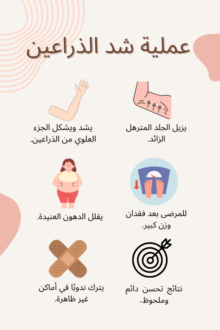 جراحة رفع الذراع