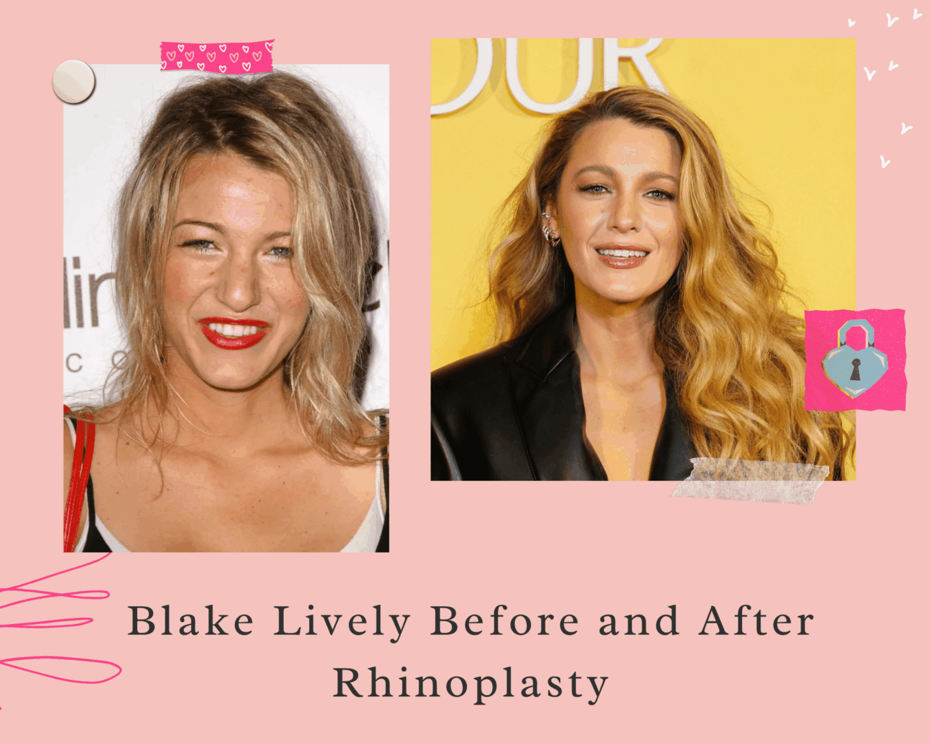 Blake Lively Rinoplasti Öncesi ve Sonrası