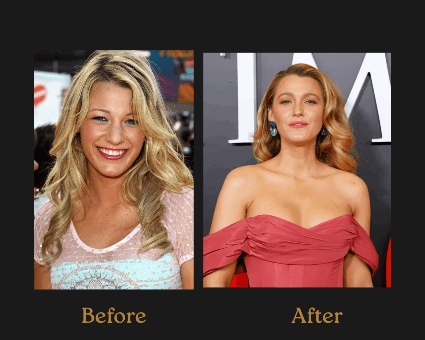Blake Lively: Old Nose and New Nose