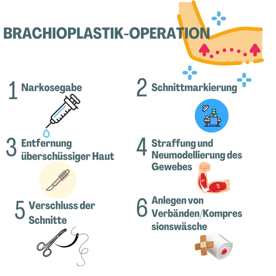 Brachioplastik-Operation 
