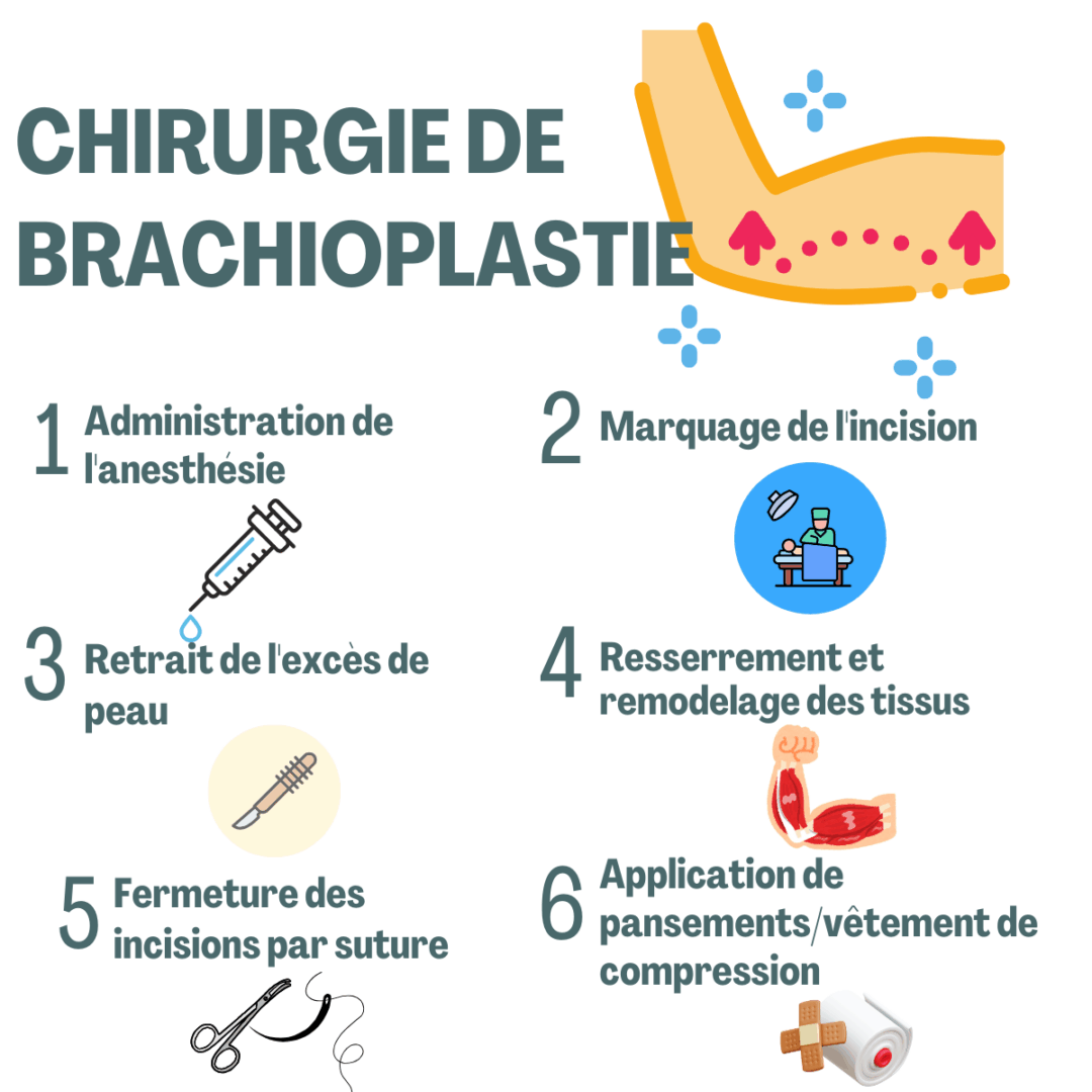 Chirurgie de Brachioplastie 