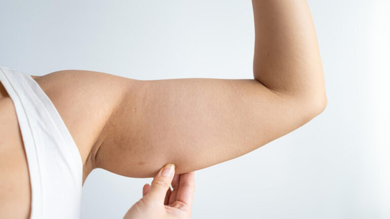 Tone Arm Surgery or Just Exercise