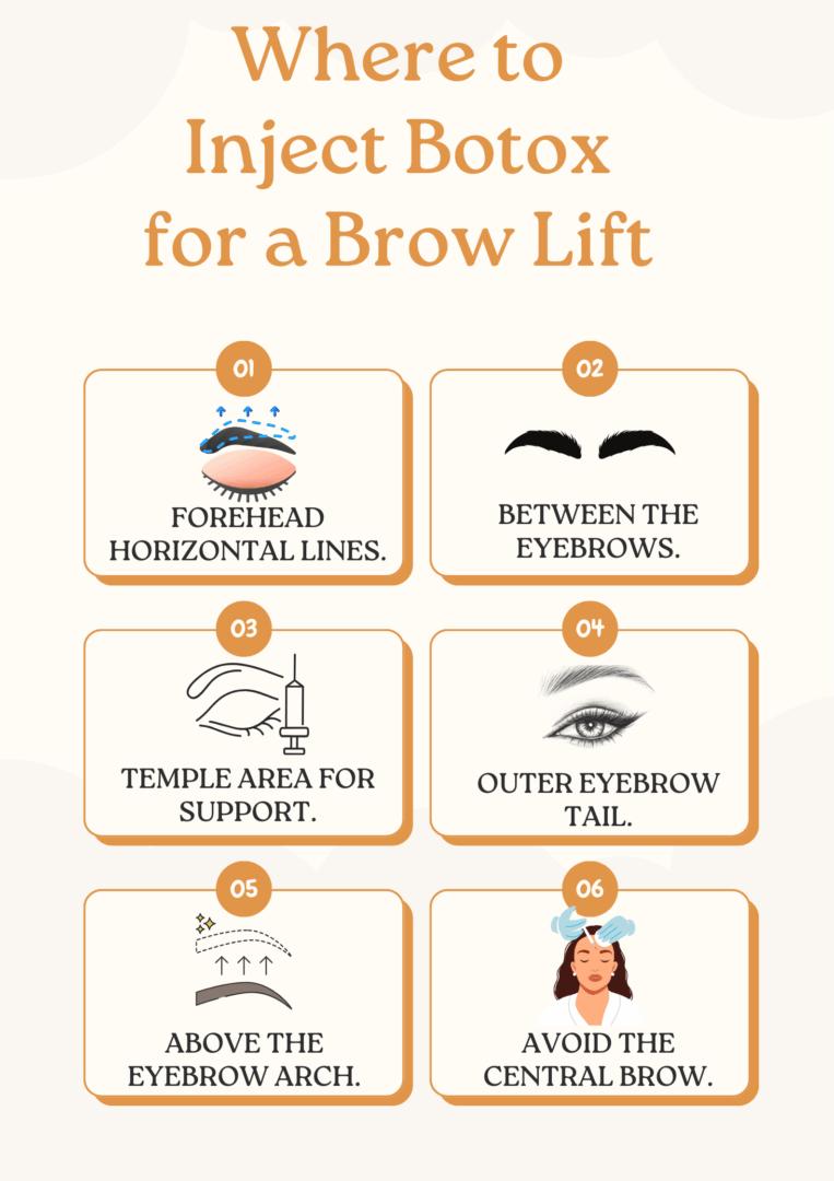 Infographic: Where to Inject Botox for a Brow Lift