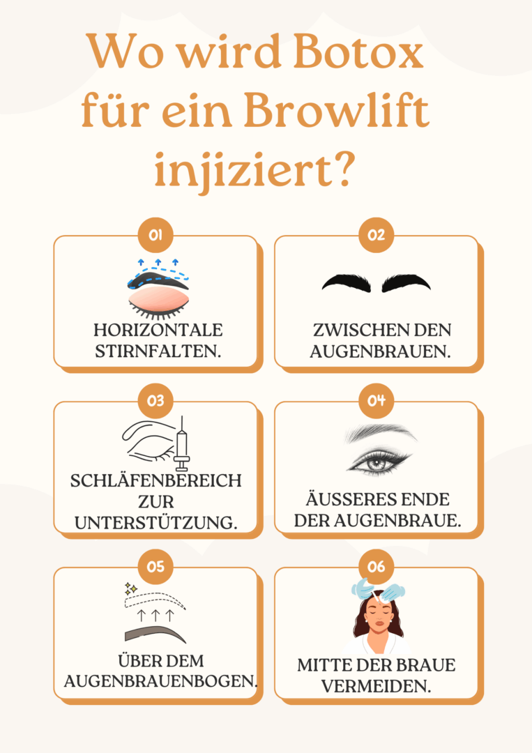 Wo wird Botox für ein Browlift injiziert 