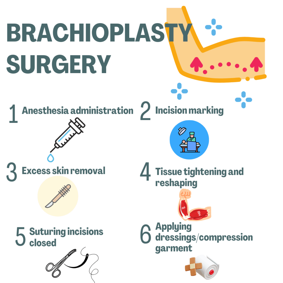 Infographic: brachioplasty surgery