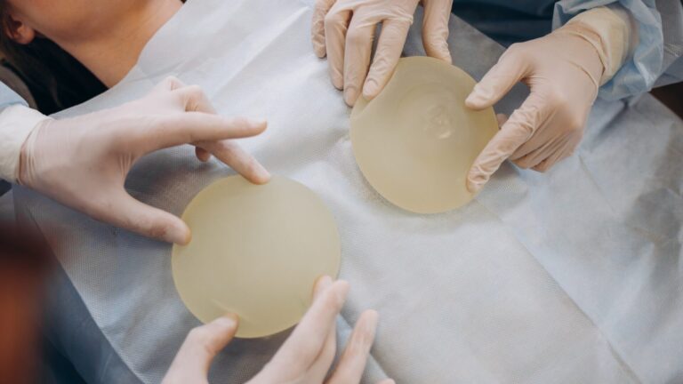 350 cc Breast Implants - Before and After
