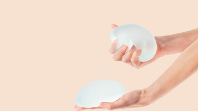 500 cc Breast Implants - Before and After