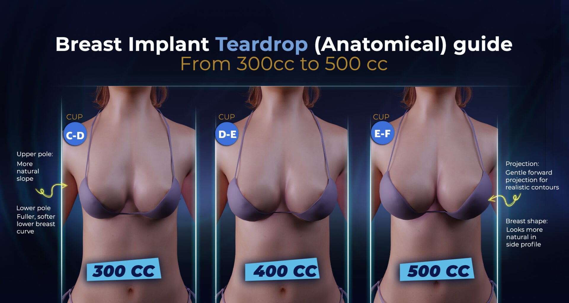 Breast Implant Cup Size Guide