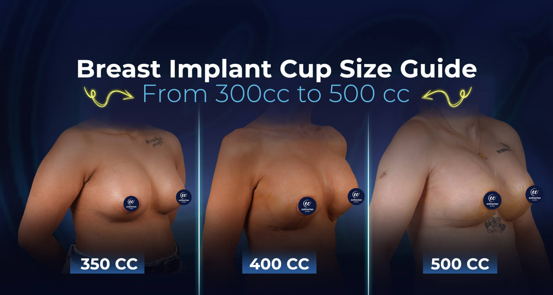 Breast-Implants Cup Size Guide (350cc, 400cc, 500cc)