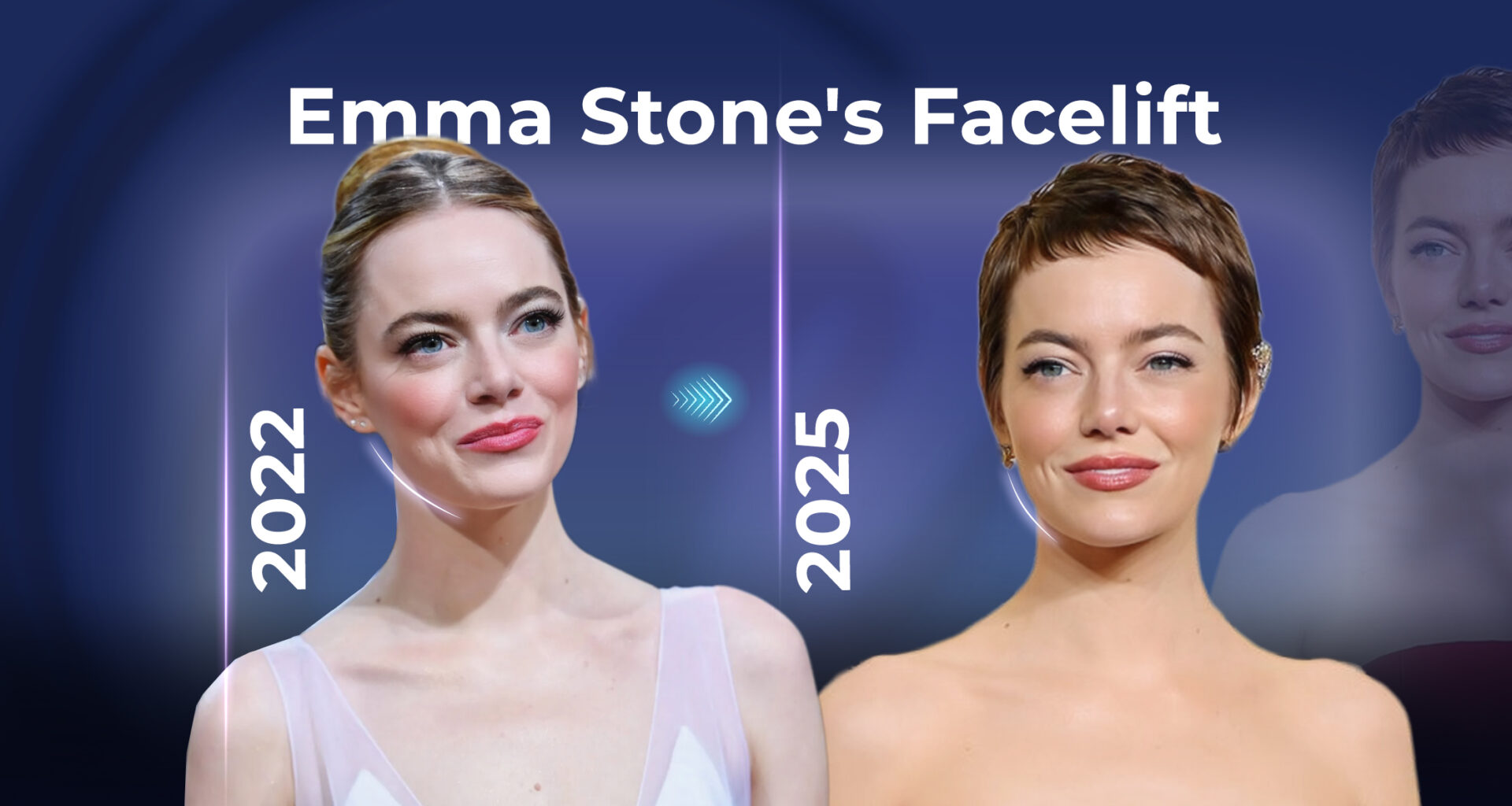 Emma Stone Schönheitsoperation (Fotos von 2022 und 2025)