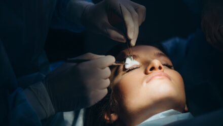 Fox Eye Surgery Before and After