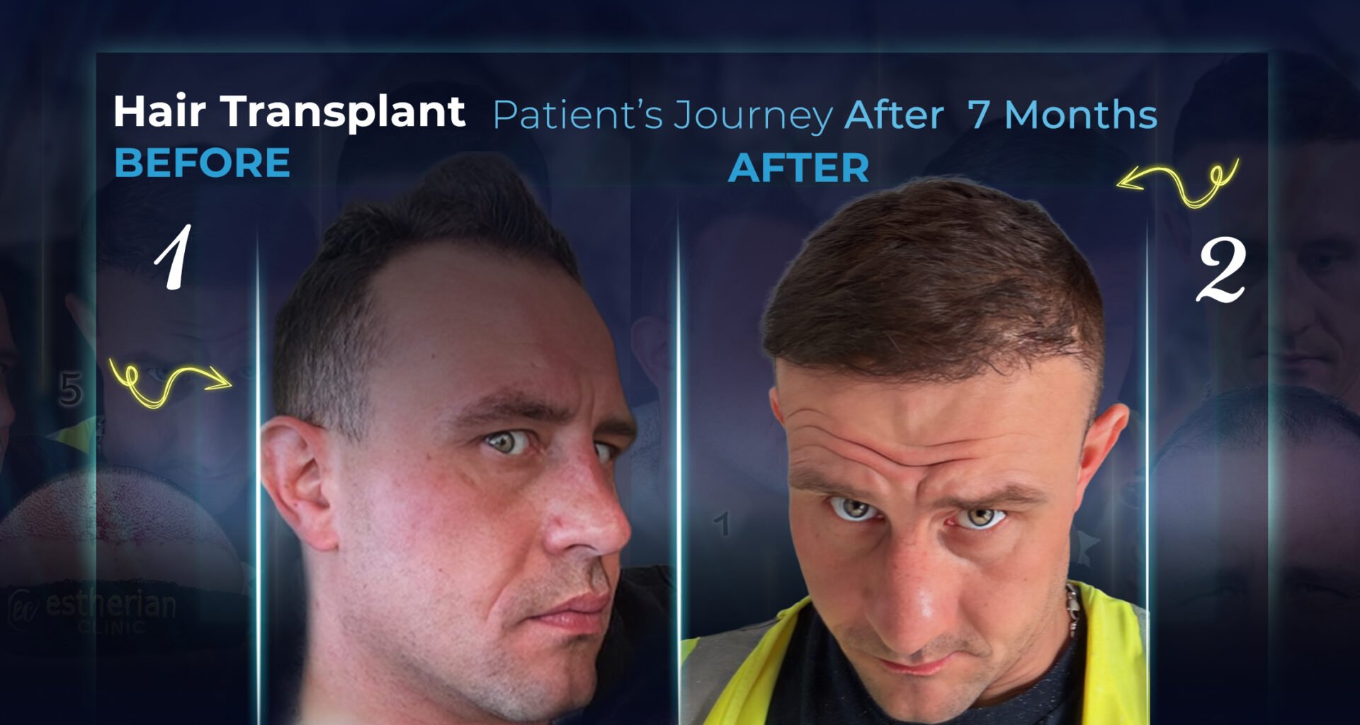 7 Monate nach dem Eingriff