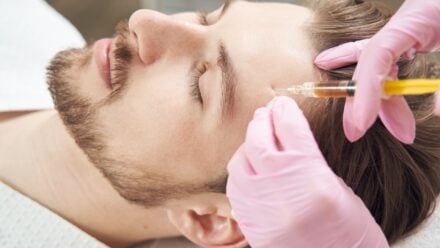 A Hair Tranpslant Case Study