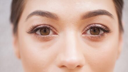 Fox Eye Surgery The Complete Guide