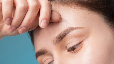 Is Forehead Reduction Surgery the Permanent Solution You're Looking For