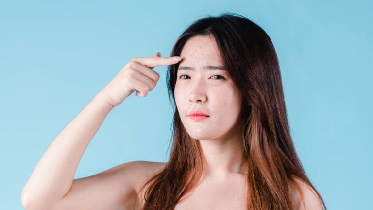 Pre-Surgery Prep Your Checklist for the Perfect Forehead Reduction Recovery