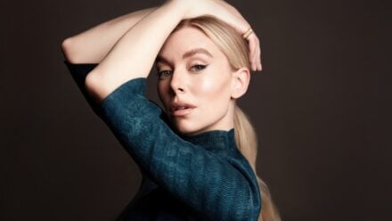 Vanessa Kirby Facelift or injectables