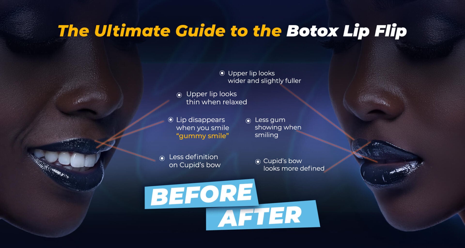 نتائج قلب الشفاه