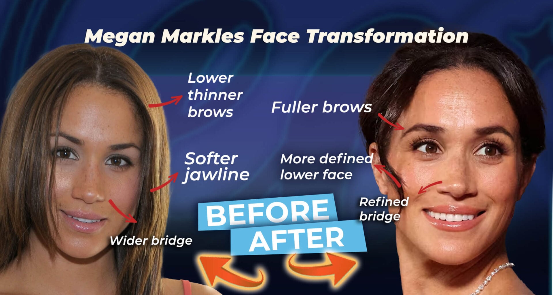 Meghan Markles (öncesi ve sonrası)