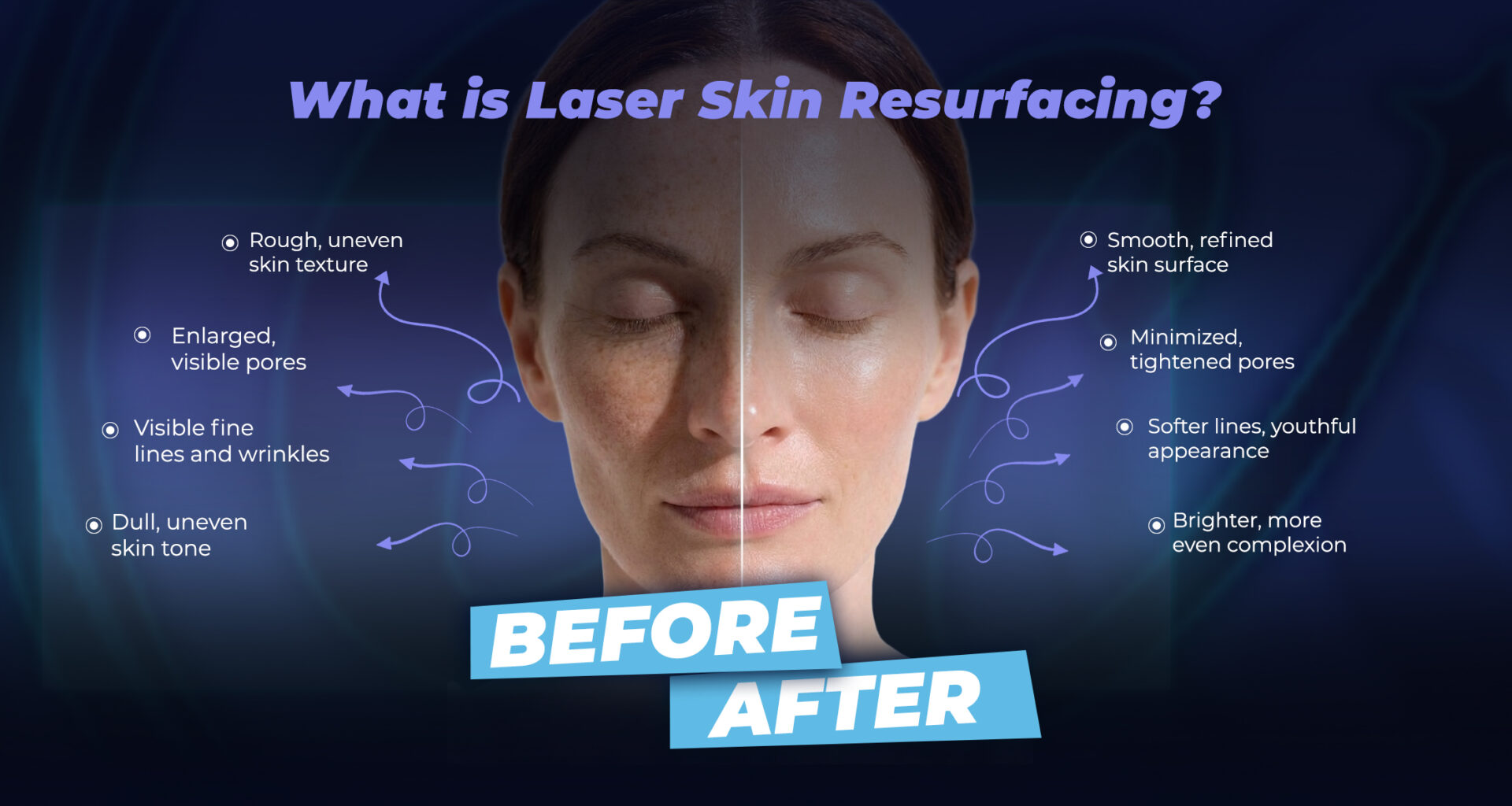 ما هو تجديد سطح الجلد بالليزر (قبل وبعد)