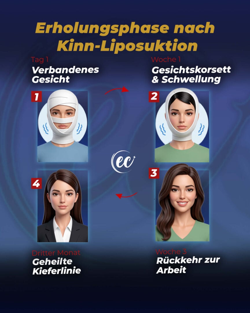 Leitfaden zur Genesung nach Kinnfettabsaugung von der Estherian Clinic