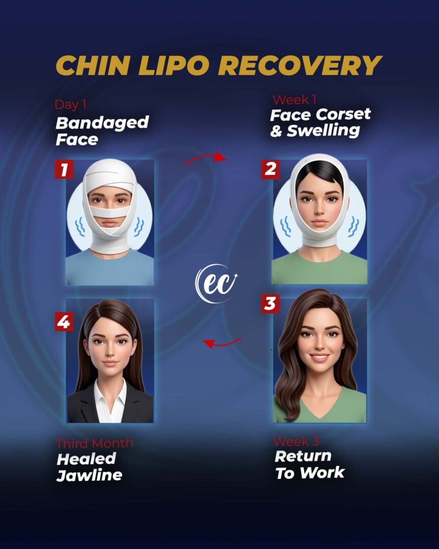 Chin lipo recovery Guide by the Estherian Clinic