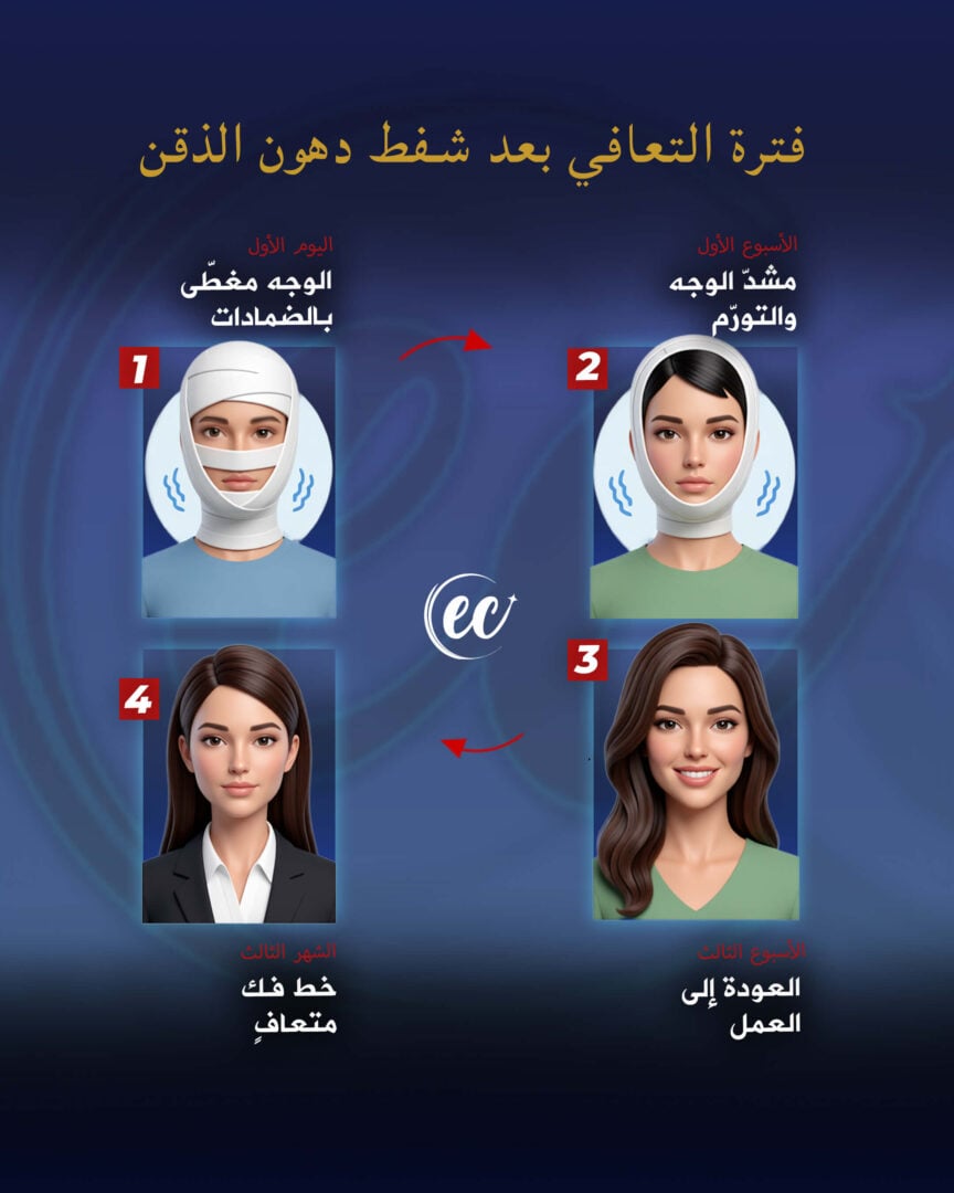 دليل التعافي بعد عملية شفط دهون الذقن من عيادة إستيريان