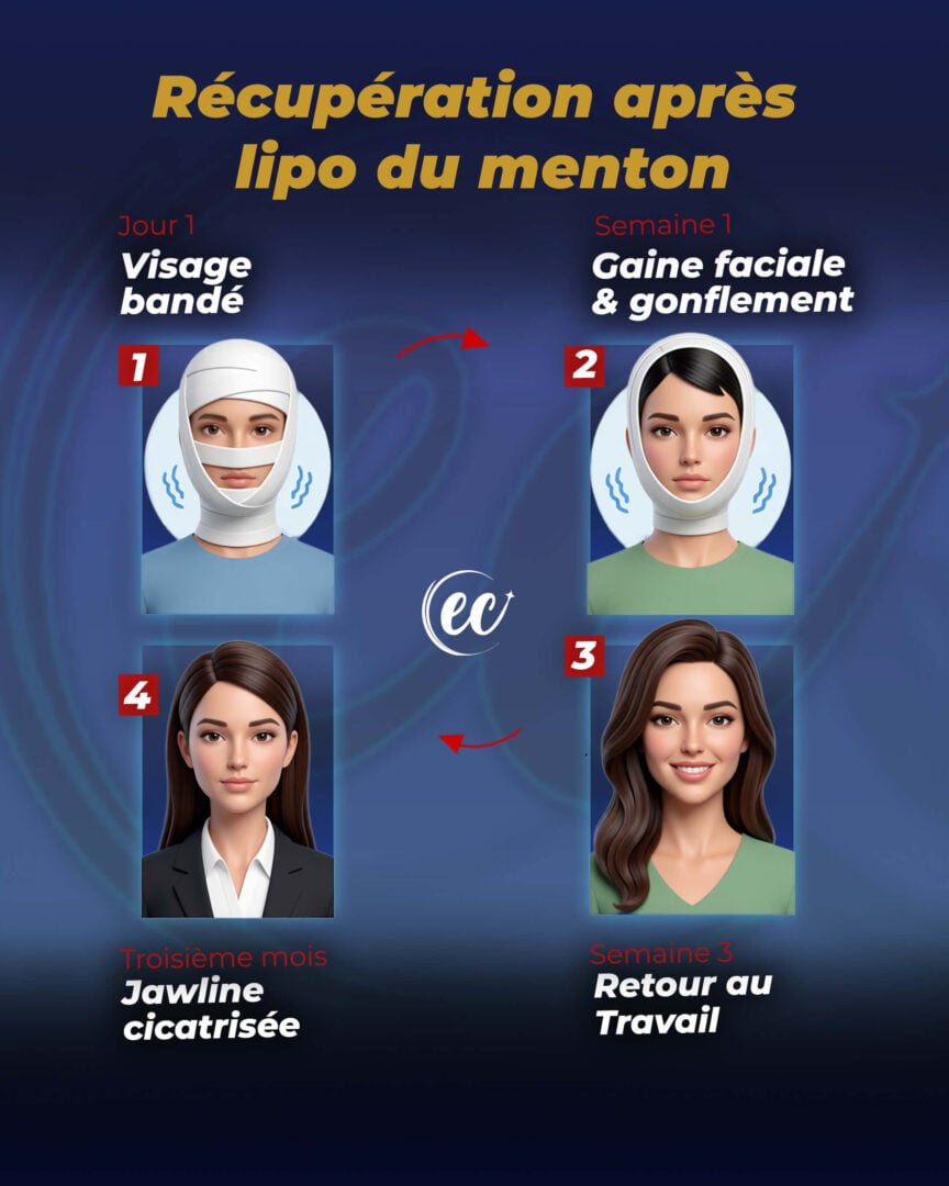 Leitfaden zur Genesung nach Kinnfettabsaugung von der Estherian Clinic.