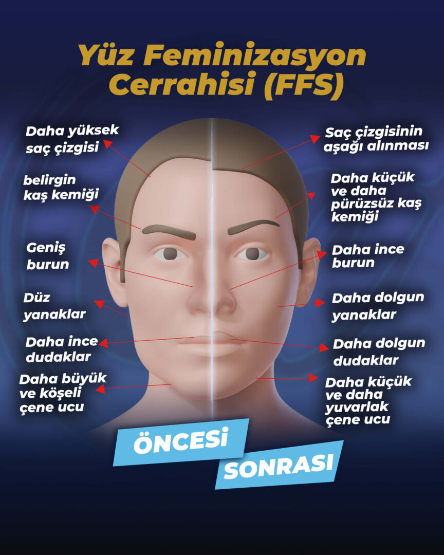 Estherian Kliniği tarafından hazırlanan Yüz Feminizasyonu Rehberi