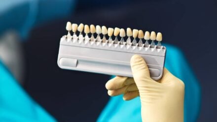 Foods that stain the teeth