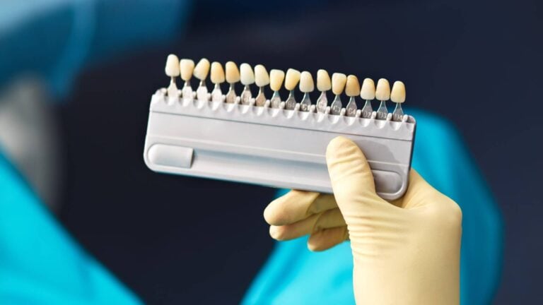 Foods that stain the teeth